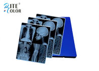 ฟิล์มเลเซอร์สีฟ้าบลูเรย์ฟิล์มเอ็กซ์เรย์ดิจิตัลสำหรับเอาต์พุตภาพ CT ของอุปกรณ์ MR MR