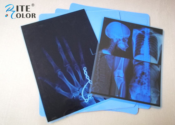 ฟิล์มถ่ายภาพทางการแพทย์แบบอิงค์เจ็ท PET สีน้ำเงินหมอกต่ำ 8 x 10 นิ้วสำหรับเครื่องพิมพ์ Epson