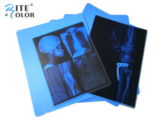 อิงค์เจ็ท PET Medical Imaging Blue X Ray Film สำหรับเครื่องพิมพ์ Canon Pixma