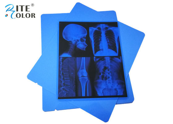 ฟิล์มถ่ายภาพทางการแพทย์ขนาด 13 X 17 นิ้ว PET Blue Inkjet Xray Radiology