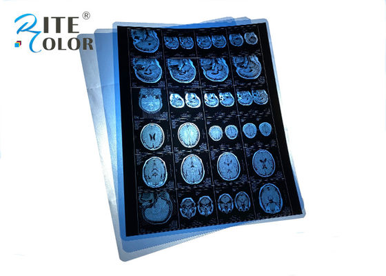 ฟิล์มรังสีเอ็กซ์เรย์ทางการแพทย์สีฟ้า PET กันน้ํา สําหรับการถ่ายภาพ MRI CT CR